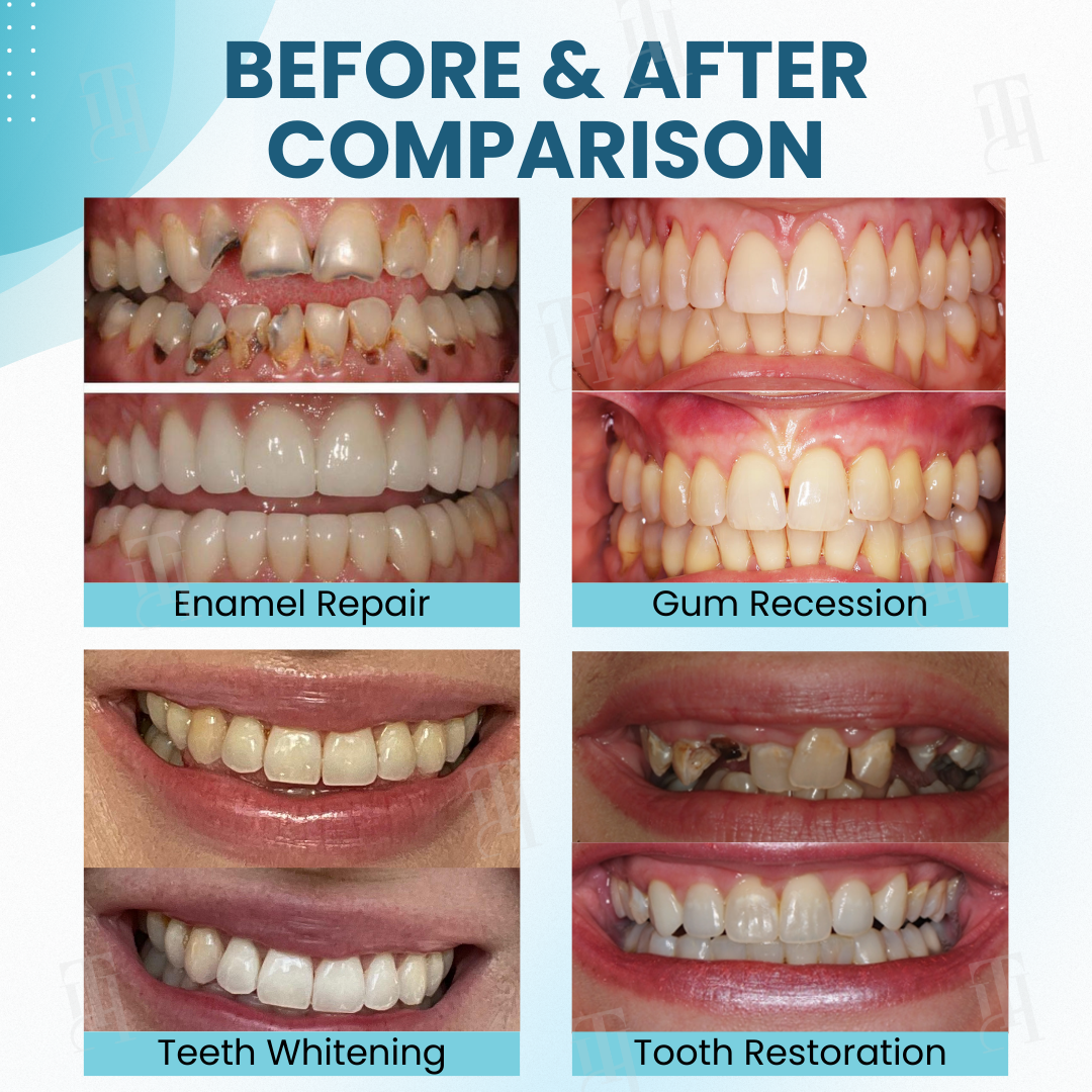 AEXZR® Makesmile Bee Venom Oral Treatment Powder