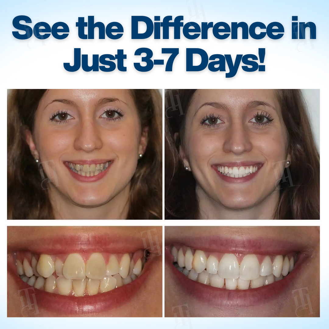 AEXZR® WhitenEase Pro Whitening Pen