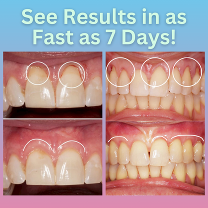 AEXZR® GumPro Therapy Agent