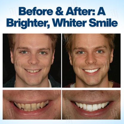 AEXZR® WhitenEase Pro Whitening Pen